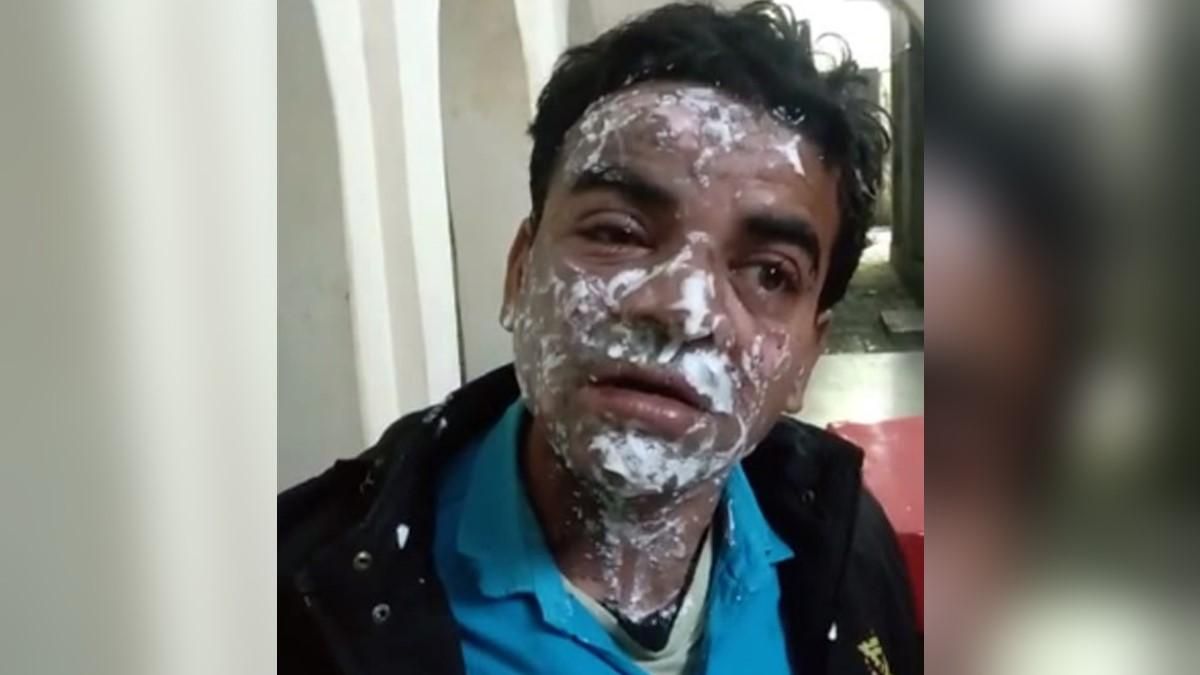 দেরির প্রশ্নে স্বামীর মুখে অ্যাসিড ছুড়ে দিলেন স্ত্রী 