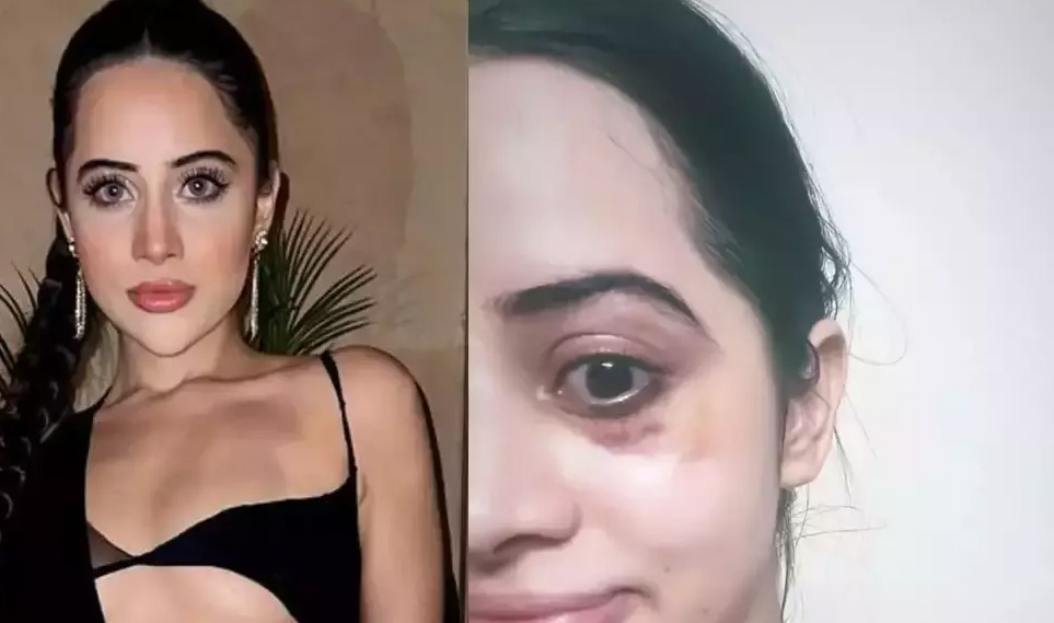 উরফির নতুন সাহসে চোখের তলায় দগদগে ঘা 