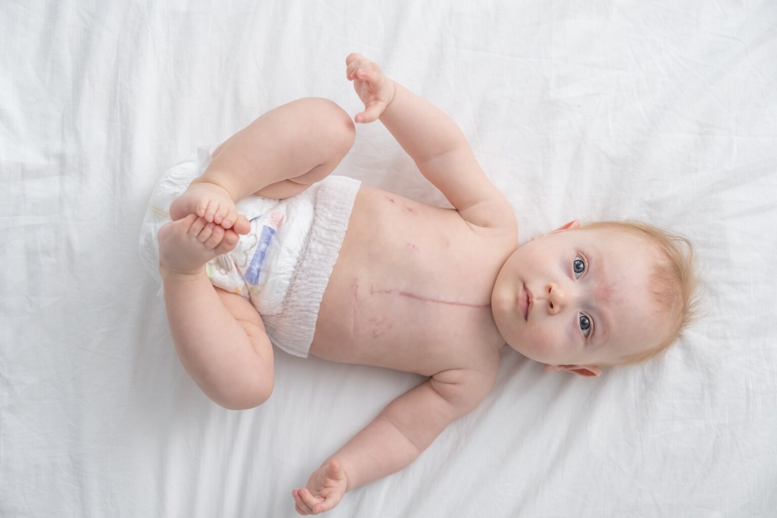 ঘাড় বাঁকলেই দ্রুত ছুটন চিকিৎসকের কাছে, নইলে…. 