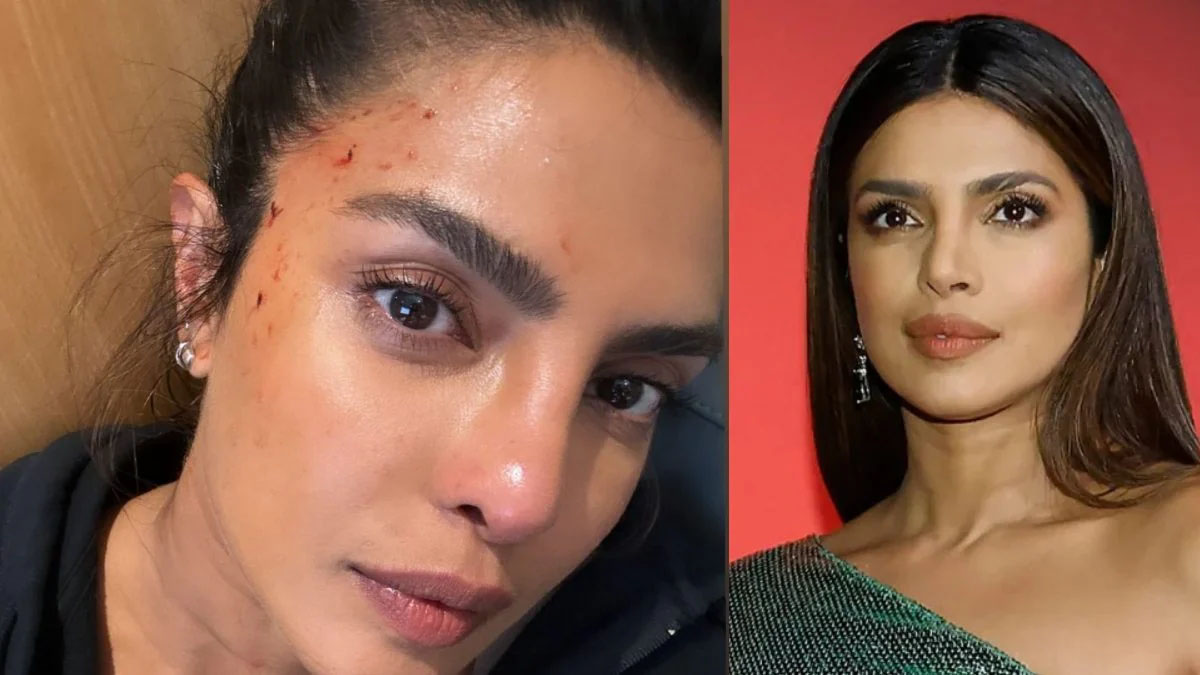 রক্তাক্ত প্রিয়াঙ্কার! 