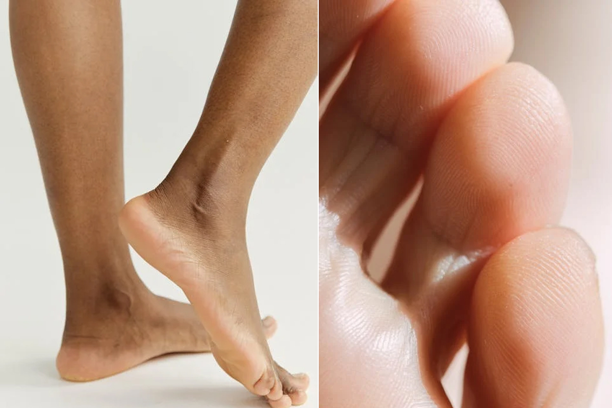 ফাটা গোড়ালির জন্য ঘরোয়া সুরক্ষা