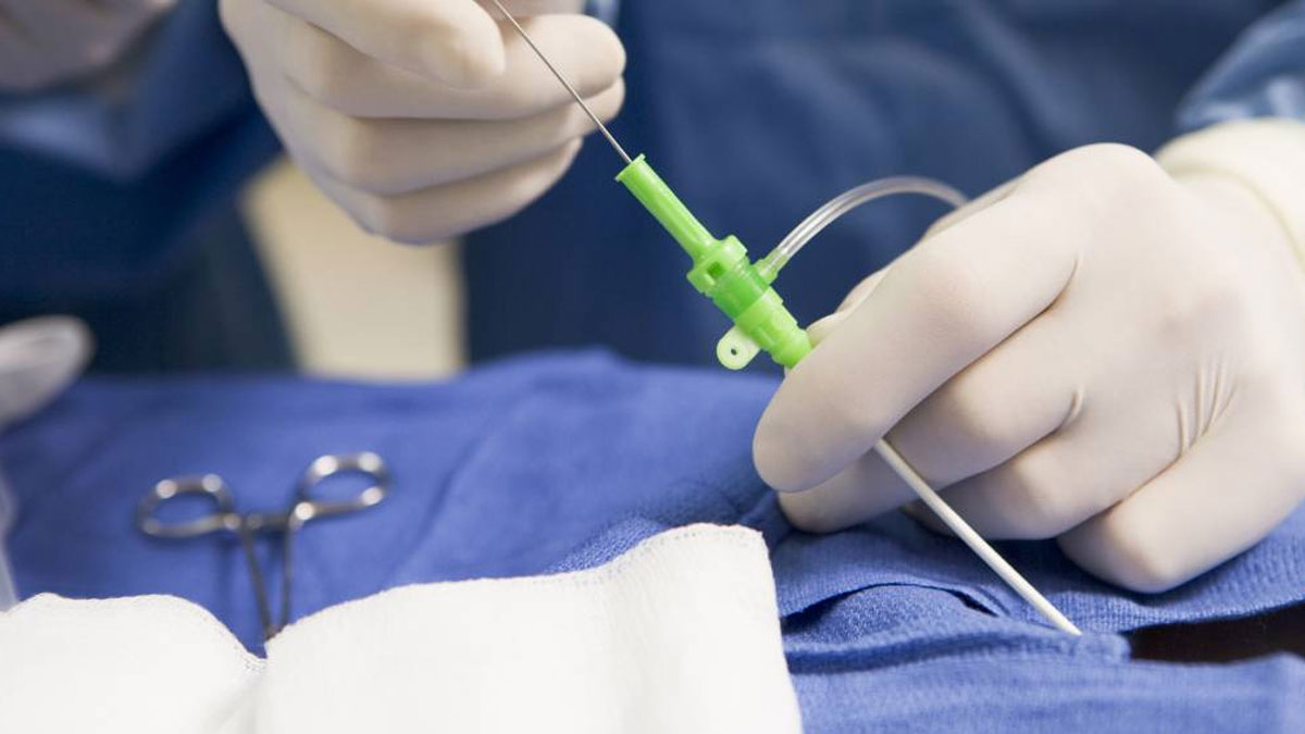 এনজিওগ্রাম কী? হৃদ্‌রোগের চিকিৎসায় এটির প্রয়োজনীয়তা