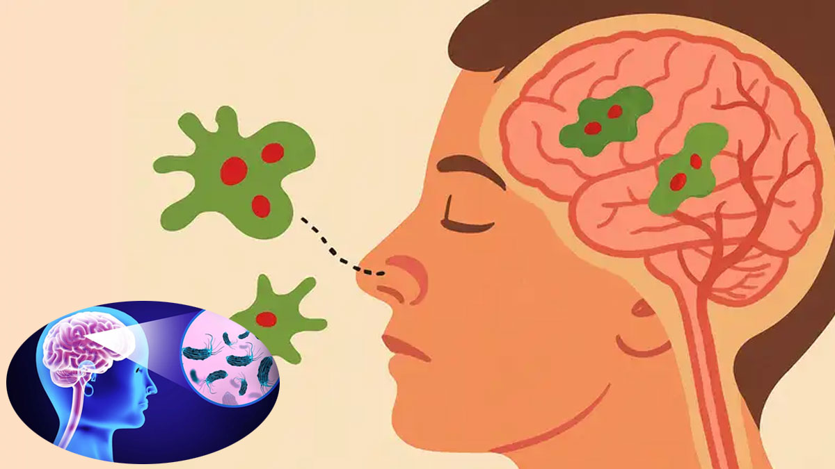 ব্রেন-ইটিং অ্যামিবার সংক্রমণে দেশে মৃত্যুহার ৯৫ শতাংশ