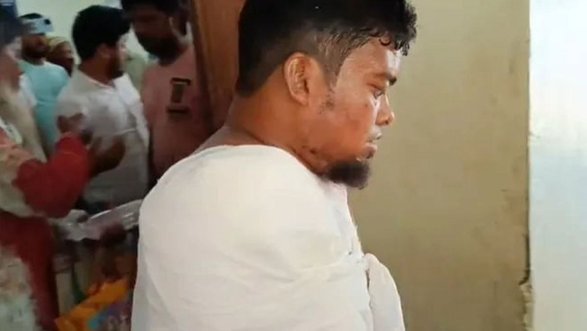 বাস ও ট্রাকের সংঘর্ষে যুবকের হাত কেটে রাস্তায় ছিটকে পড়ল