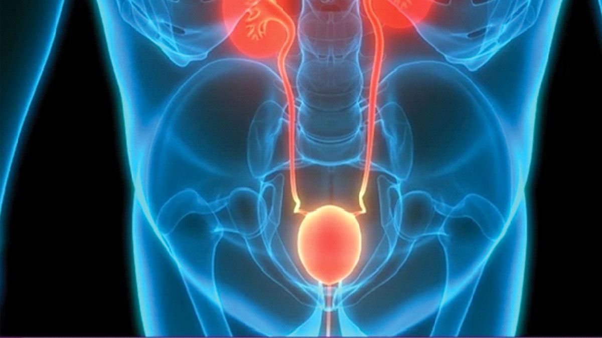 বিরল অস্ত্রোপচারে জটিল কিডনি রোগের সমাধান